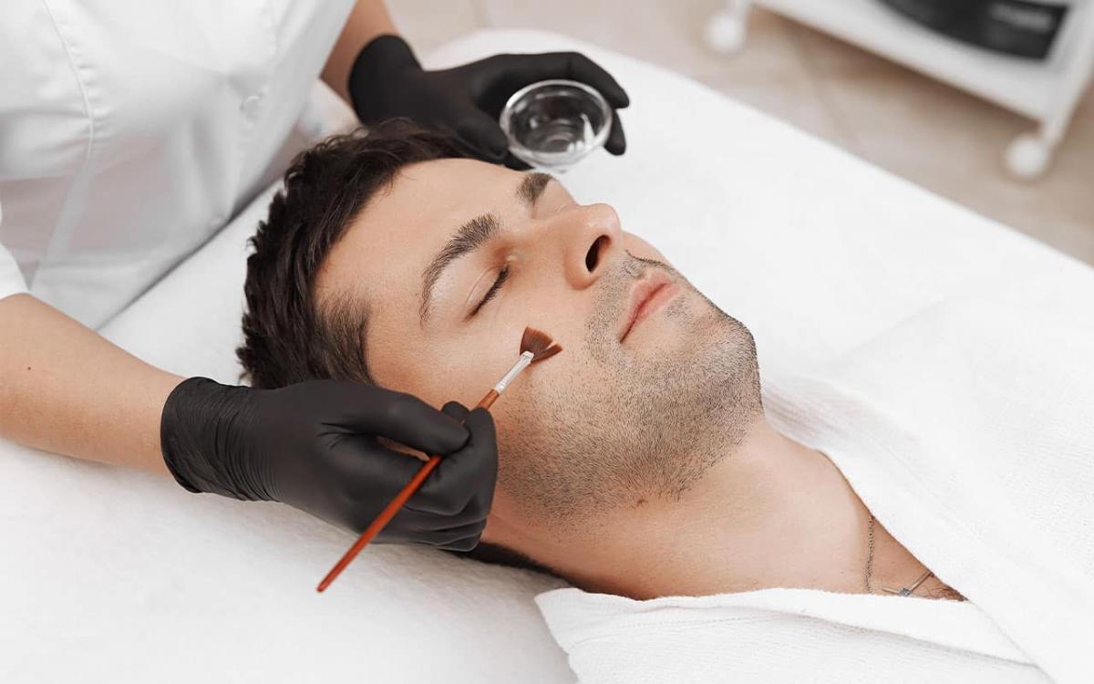 chemical peel for men