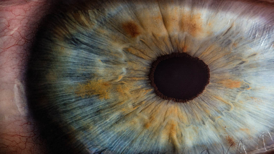 stye
