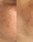 Hydro-Glo Peel Pads 40%