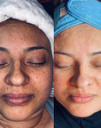 Glycolic 50% Gel Peel