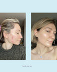 Hydro-Glo Peel Pads 10%