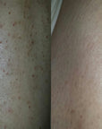 Gly + Sal Exfoliating Body Lotion