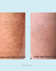 Gly + Sal Exfoliating Body Lotion