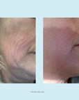 Hydra-Repair Wrinkle Cream