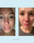 Glycolic 30% Gel Peel