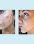 Salicylic Deep Gel Cleanser