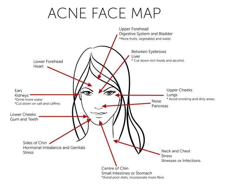 Acne face map featured image