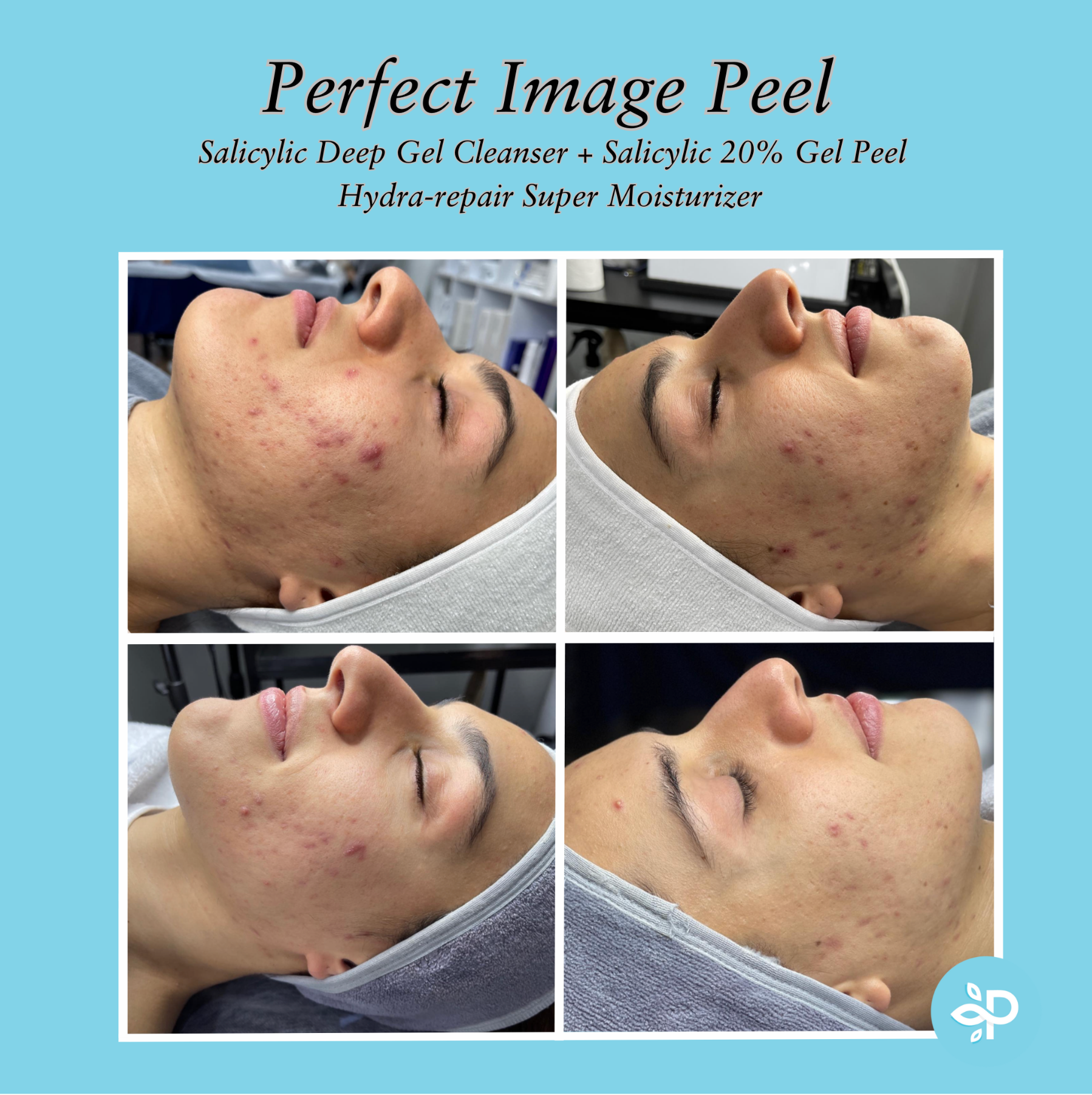 Hydra-Repair Super Moisturizer