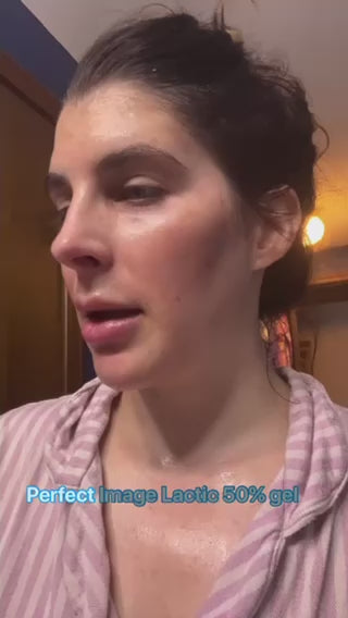 Lactic 50% Gel Peel – Perfect Image